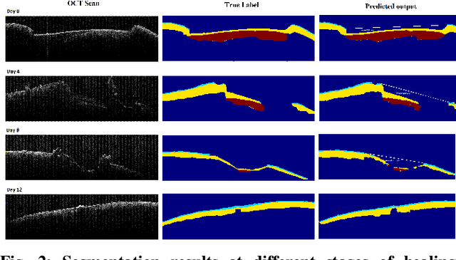 Figure 2 for Deep Learning based Skin-layer Segmentation for Characterizing Cutaneous Wounds from Optical Coherence Tomography Images