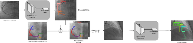 Figure 3 for Data Augmentation through Pseudolabels in Automatic Region Based Coronary Artery Segmentation for Disease Diagnosis