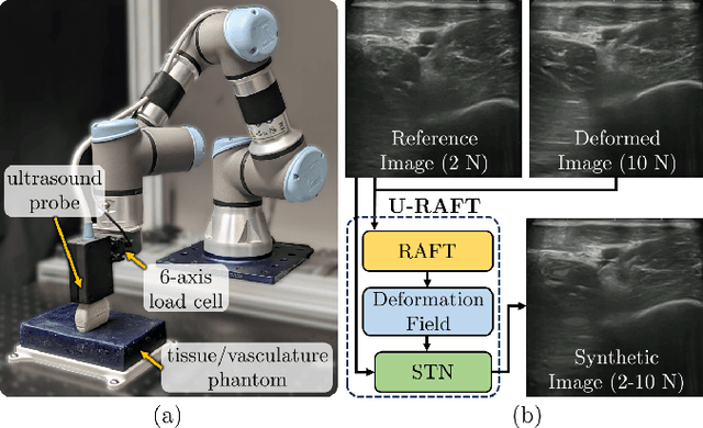 Figure 1 for Unsupervised Deformable Ultrasound Image Registration and Its Application for Vessel Segmentation