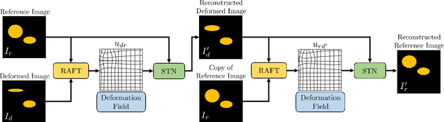 Figure 2 for Unsupervised Deformable Ultrasound Image Registration and Its Application for Vessel Segmentation