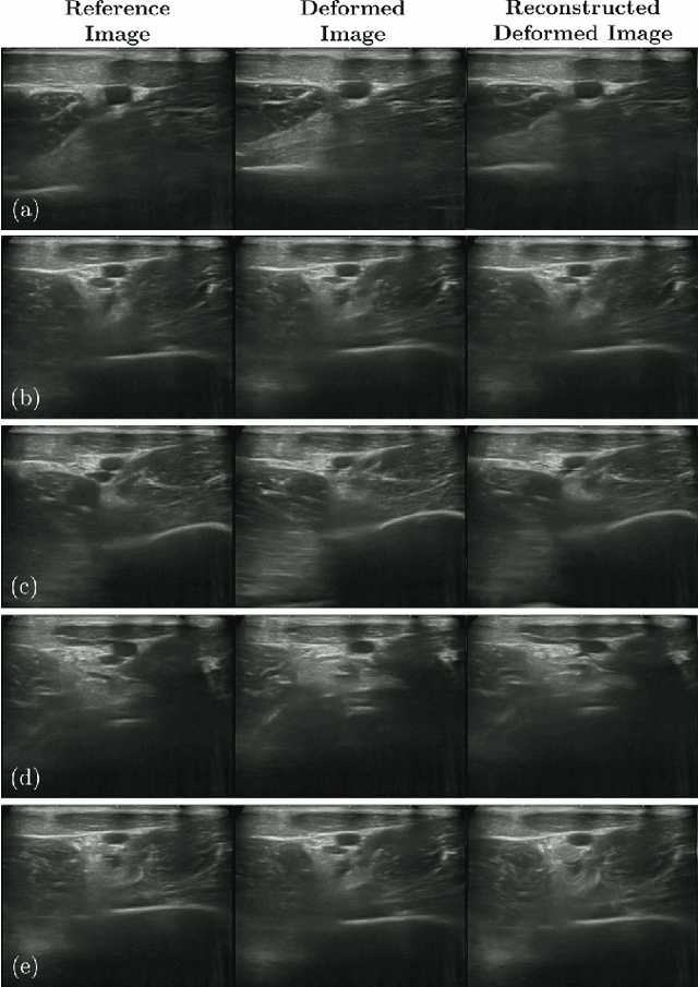 Figure 4 for Unsupervised Deformable Ultrasound Image Registration and Its Application for Vessel Segmentation