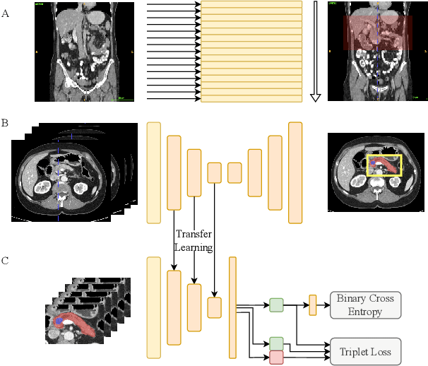 Figure 1 for Exploiting segmentation labels and representation learning to forecast therapy response of PDAC patients