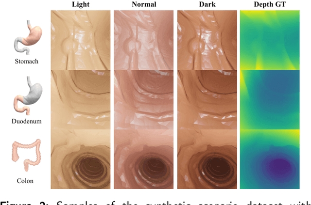 Figure 3 for A geometry-aware deep network for depth estimation in monocular endoscopy