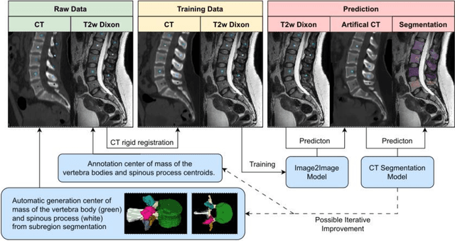 Figure 1 for Denoising diffusion-based MR to CT image translation enables whole spine vertebral segmentation in 2D and 3D without manual annotations