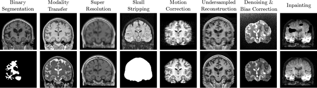Figure 3 for Neuralizer: General Neuroimage Analysis without Re-Training