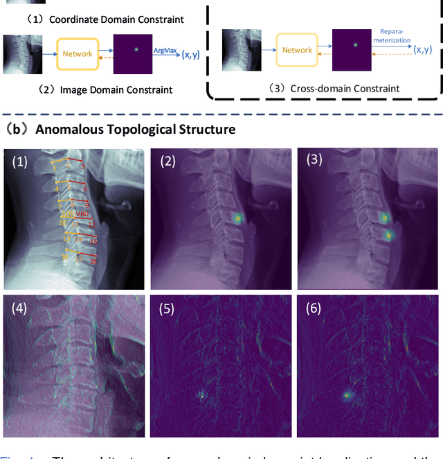 Figure 1 for Topology-inspired Cross-domain Network for Developmental Cervical Stenosis Quantification