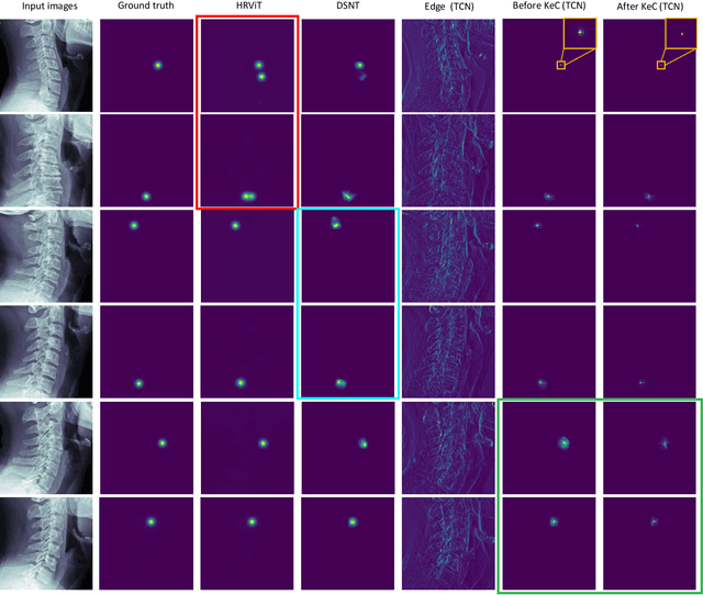 Figure 3 for Topology-inspired Cross-domain Network for Developmental Cervical Stenosis Quantification