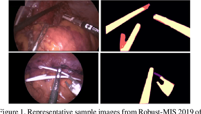 Figure 1 for SegMatch: A semi-supervised learning method for surgical instrument segmentation