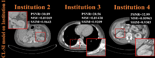 Figure 4 for A Peer-to-peer Federated Continual Learning Network for Improving CT Imaging from Multiple Institutions