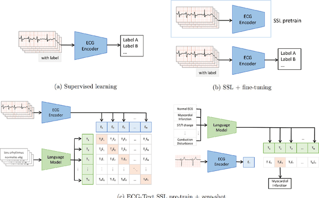 Figure 1 for Frozen Language Model Helps ECG Zero-Shot Learning