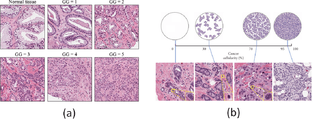 Figure 1 for A Comprehensive Overview of Computational Nuclei Segmentation Methods in Digital Pathology