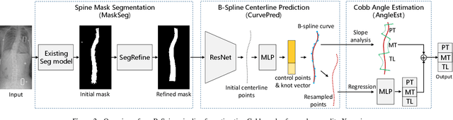 Figure 3 for B-Spine: Learning B-Spline Curve Representation for Robust and Interpretable Spinal Curvature Estimation