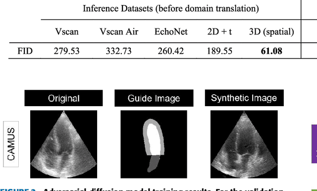 Figure 3 for A Domain Translation Framework with an Adversarial Denoising Diffusion Model to Generate Synthetic Datasets of Echocardiography Images