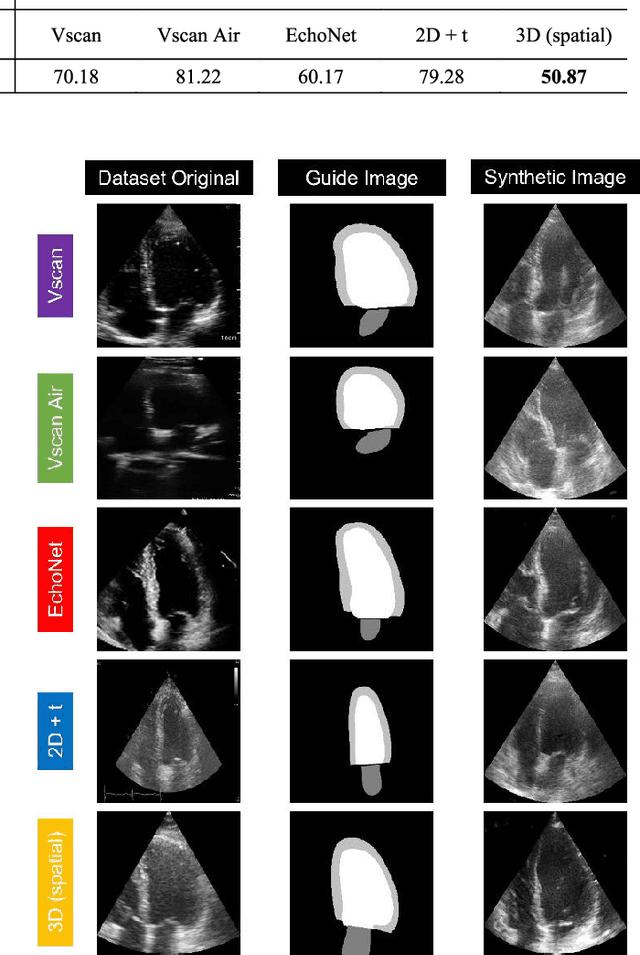 Figure 4 for A Domain Translation Framework with an Adversarial Denoising Diffusion Model to Generate Synthetic Datasets of Echocardiography Images