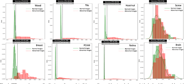 Figure 4 for Industrial and Medical Anomaly Detection Through Cycle-Consistent Adversarial Networks