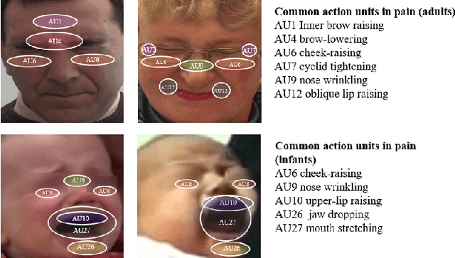 Figure 1 for AuE-IPA: An AU Engagement Based Infant Pain Assessment Method