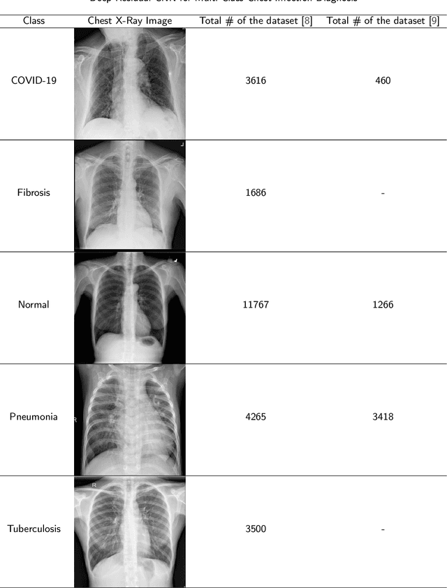 Figure 2 for Deep Residual CNN for Multi-Class Chest Infection Diagnosis