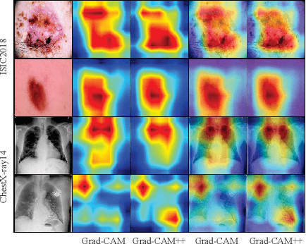 Figure 3 for Spatio-Temporal Structure Consistency for Semi-supervised Medical Image Classification