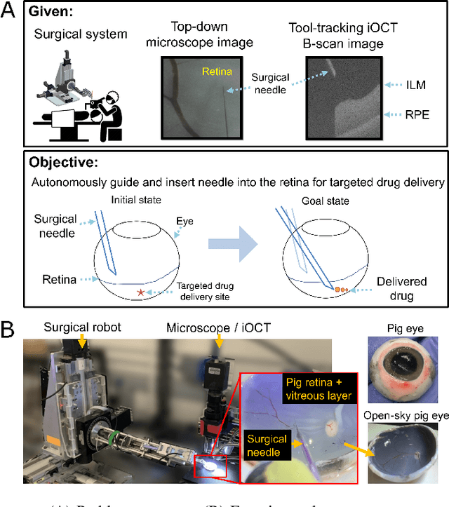 Figure 1 for Deep Learning Guided Autonomous Retinal Surgery using a Robotic Arm, Microscopy, and iOCT Imaging