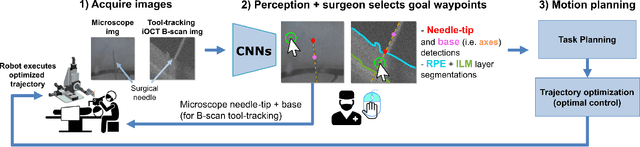 Figure 2 for Deep Learning Guided Autonomous Retinal Surgery using a Robotic Arm, Microscopy, and iOCT Imaging