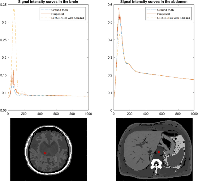 Figure 4 for Accelerated Dynamic Magnetic Resonance Imaging from Spatial-Subspace Reconstructions (SPARS)