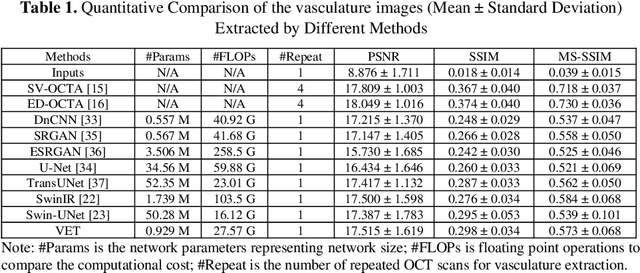 Figure 2 for Deep-Learning-based Vasculature Extraction for Single-Scan Optical Coherence Tomography Angiography