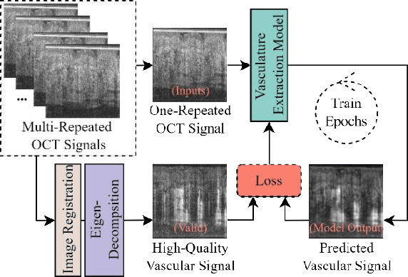 Figure 1 for Deep-Learning-based Vasculature Extraction for Single-Scan Optical Coherence Tomography Angiography