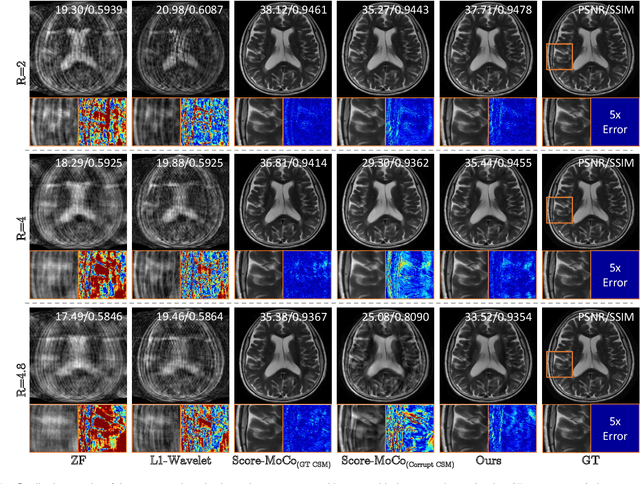 Figure 2 for JSMoCo: Joint Coil Sensitivity and Motion Correction in Parallel MRI with a Self-Calibrating Score-Based Diffusion Model