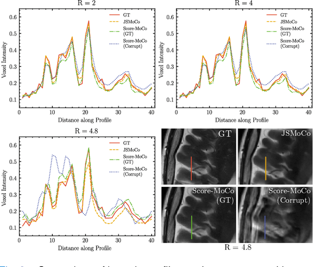 Figure 3 for JSMoCo: Joint Coil Sensitivity and Motion Correction in Parallel MRI with a Self-Calibrating Score-Based Diffusion Model