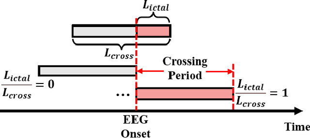 Figure 2 for Deep Learning for Short-Latency Epileptic Seizure Detection with Probabilistic Classification