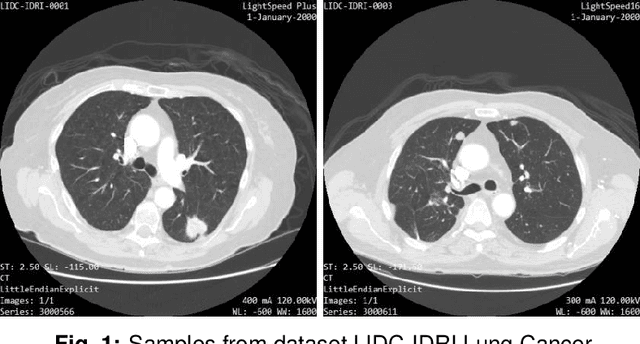 Figure 1 for Identification of lung nodules CT scan using YOLOv5 based on convolution neural network