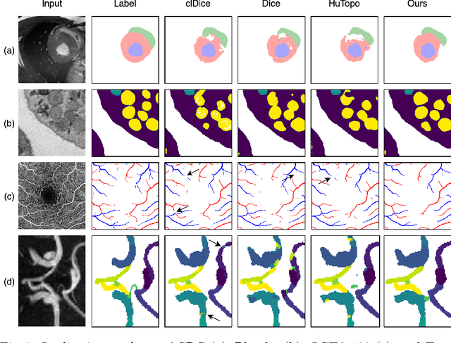 Figure 3 for Topologically faithful multi-class segmentation in medical images