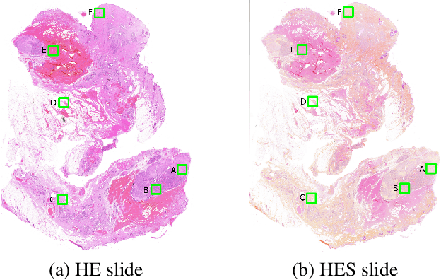 Figure 2 for Enabling Collagen Quantification on HE-stained Slides Through Stain Deconvolution and Restained HE-HES