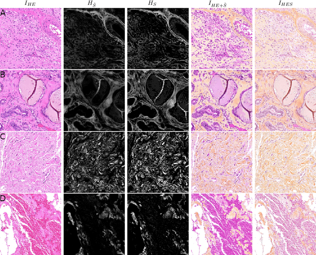 Figure 4 for Enabling Collagen Quantification on HE-stained Slides Through Stain Deconvolution and Restained HE-HES