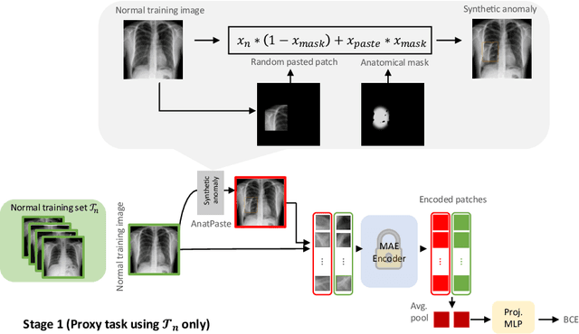 Figure 1 for AMAE: Adaptation of Pre-Trained Masked Autoencoder for Dual-Distribution Anomaly Detection in Chest X-Rays