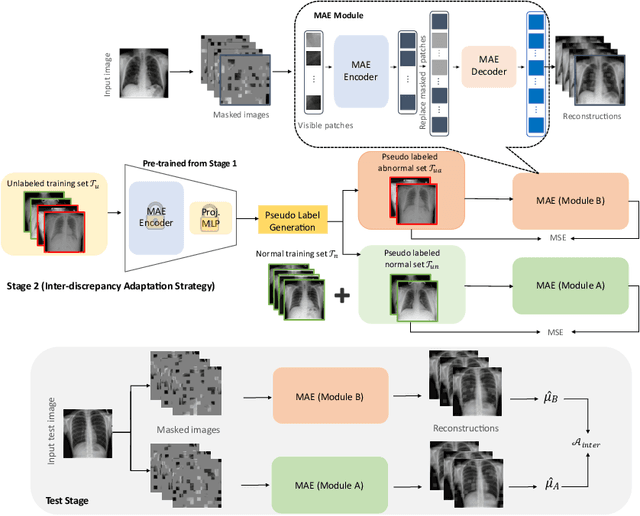 Figure 2 for AMAE: Adaptation of Pre-Trained Masked Autoencoder for Dual-Distribution Anomaly Detection in Chest X-Rays