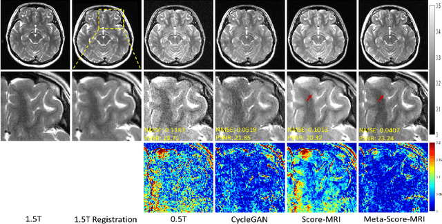 Figure 3 for Meta-Learning Enabled Score-Based Generative Model for 1.5T-Like Image Reconstruction from 0.5T MRI