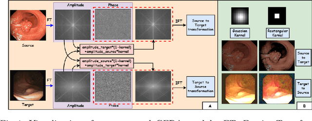 Figure 2 for Semi-supervised Domain Adaptive Medical Image Segmentation through Consistency Regularized Disentangled Contrastive Learning