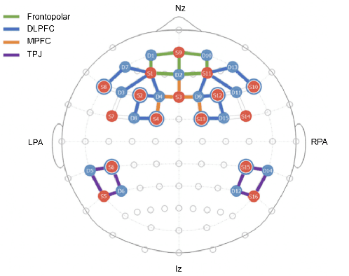 Figure 2 for Stringesthesia: Dynamically Shifting Musical Agency Between Audience and Performer Based on Trust in an Interactive and Improvised Performance