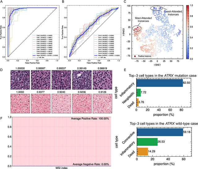 Figure 4 for Deep Learning Predicts Biomarker Status and Discovers Related Histomorphology Characteristics for Low-Grade Glioma