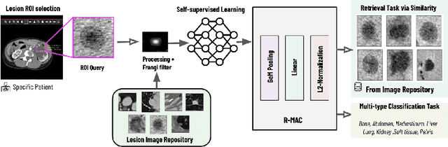 Figure 1 for Lesion Search with Self-supervised Learning