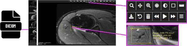 Figure 3 for Lesion Search with Self-supervised Learning