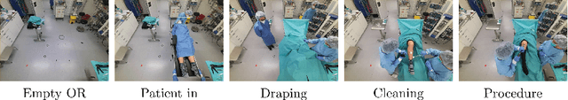 Figure 1 for Depth-Supervised NeRF for Multi-View RGB-D Operating Room Images