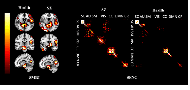 Figure 3 for MultiCrossViT: Multimodal Vision Transformer for Schizophrenia Prediction using Structural MRI and Functional Network Connectivity Data