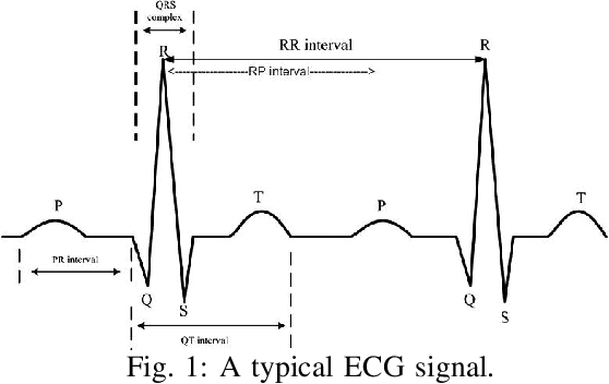 Figure 1 for Runtime Monitoring and Statistical Approaches for Correlation Analysis of ECG and PPG