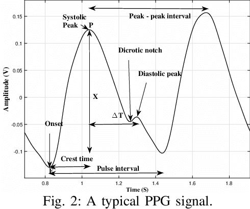 Figure 2 for Runtime Monitoring and Statistical Approaches for Correlation Analysis of ECG and PPG