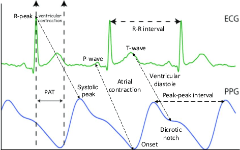 Figure 3 for Runtime Monitoring and Statistical Approaches for Correlation Analysis of ECG and PPG