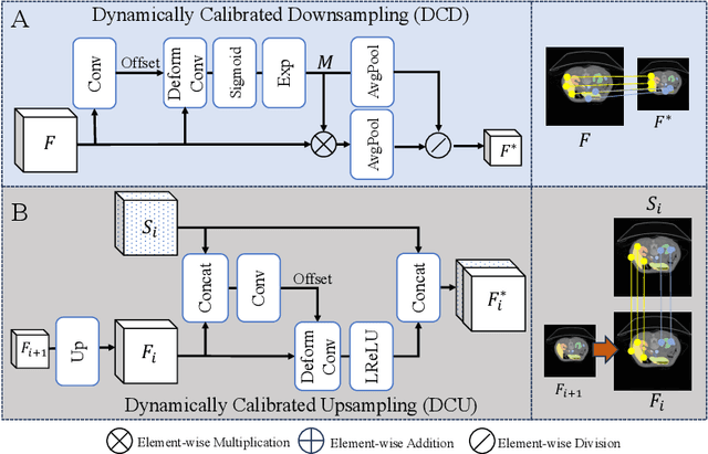 Figure 3 for Dynamic U-Net: Adaptively Calibrate Features for Abdominal Multi-organ Segmentation