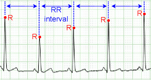 Figure 1 for Efficient and Direct Inference of Heart Rate Variability using Both Signal Processing and Machine Learning