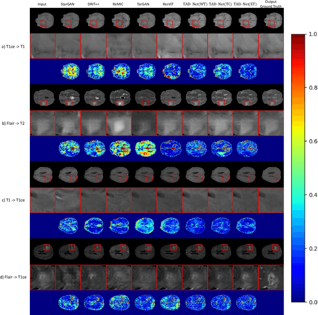 Figure 3 for Unsupervised Tumor-Aware Distillation for Multi-Modal Brain Image Translation